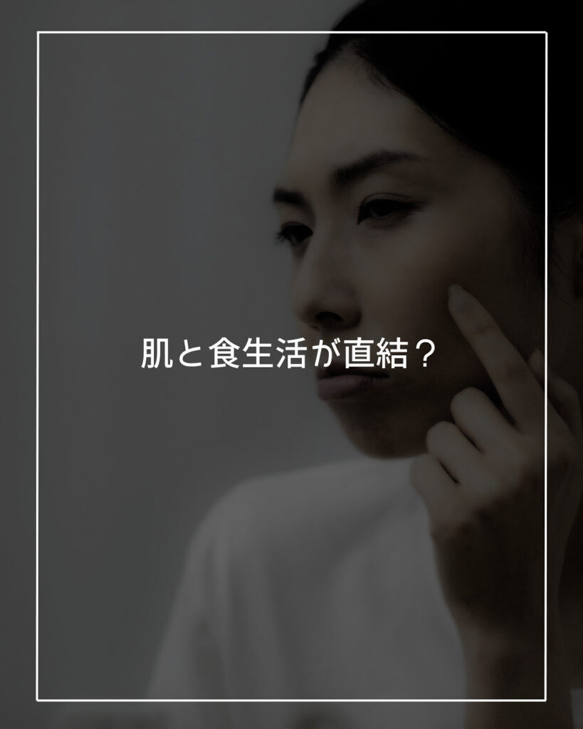 肌と食生活が直結　食生活は肌に出る